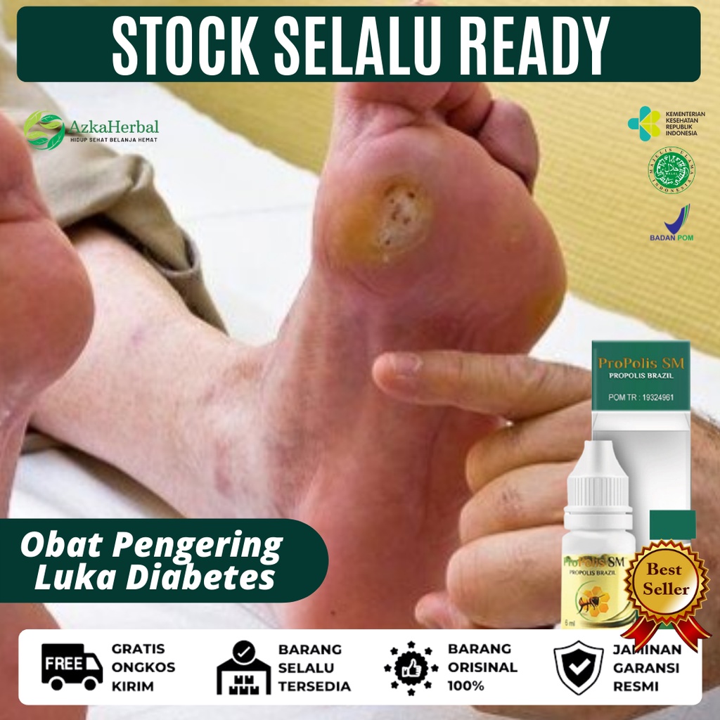 Jual Obat Pengering Luka Diabetes, Obat Luka Diabetes Bernanah, Luka