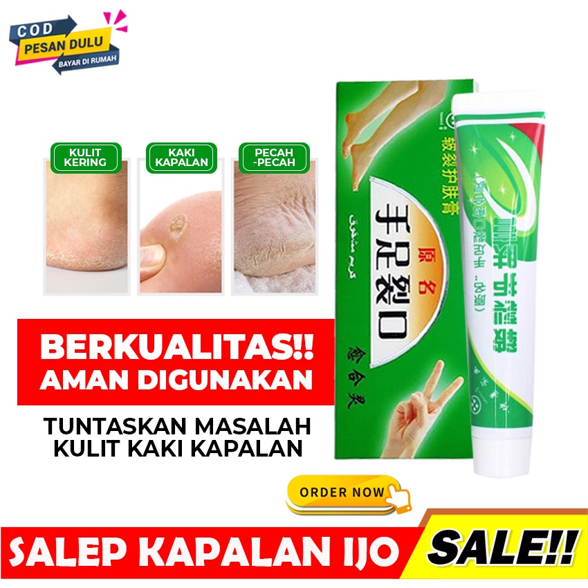 Jual [ PALING AMPUH ] SALEP KRIM MENGATASI TUMIT KAKI TANGAN KERING