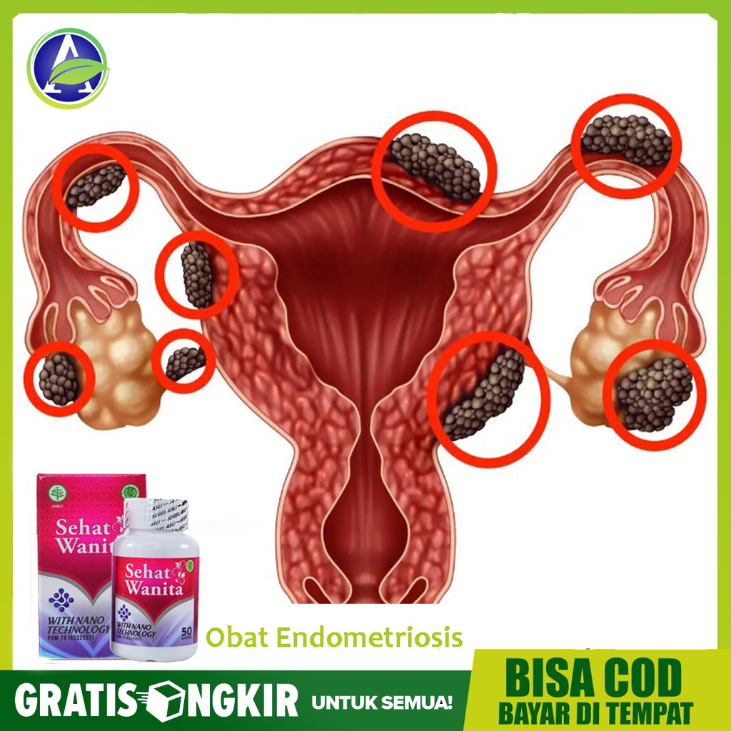 Jual Obat Endometriosis, Kista Endometriosis, Kista Coklat Sehat Wanita 50 Kapsul Asli - Bisa Cod | Shopee Indonesia