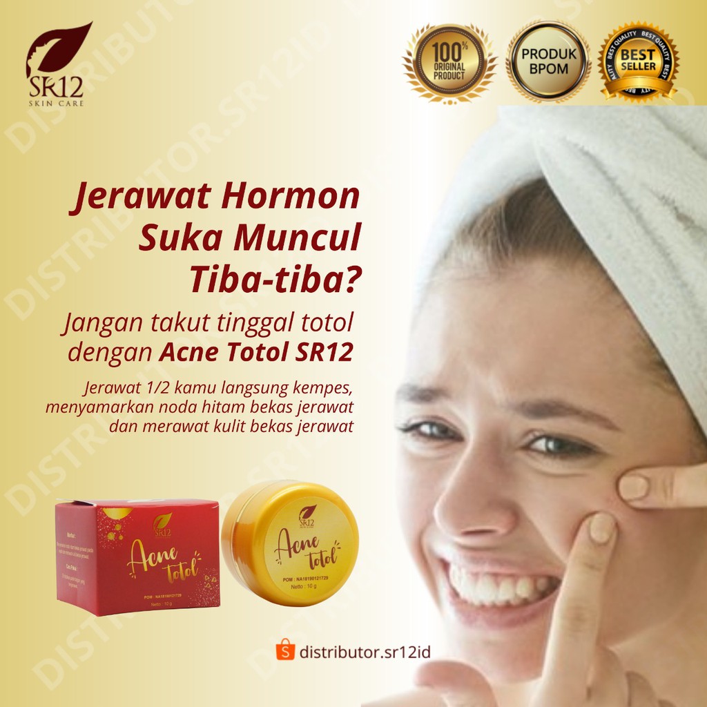 ACNE TOTOL SR12 HERBAL / CREAM JERAWAT AMPUH / JERAWAT KEMPES KERING
