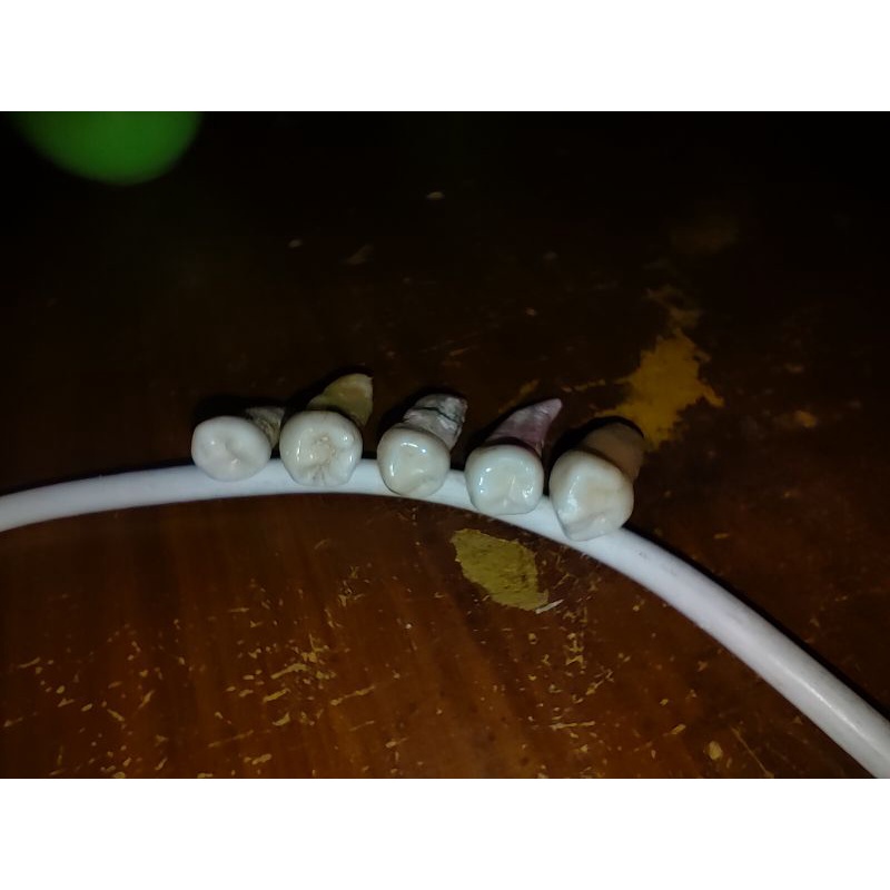 Jual gigi praktikum premolar 1 dan 2 rahang bawah free caries dan perfect Shopee Indonesia