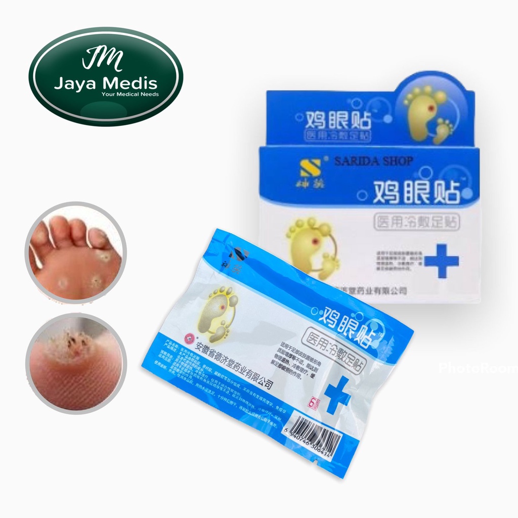 Jual Plester Kutil Mata Ikan Kaki Kapalan Ji Yan Gao Shopee Indonesia