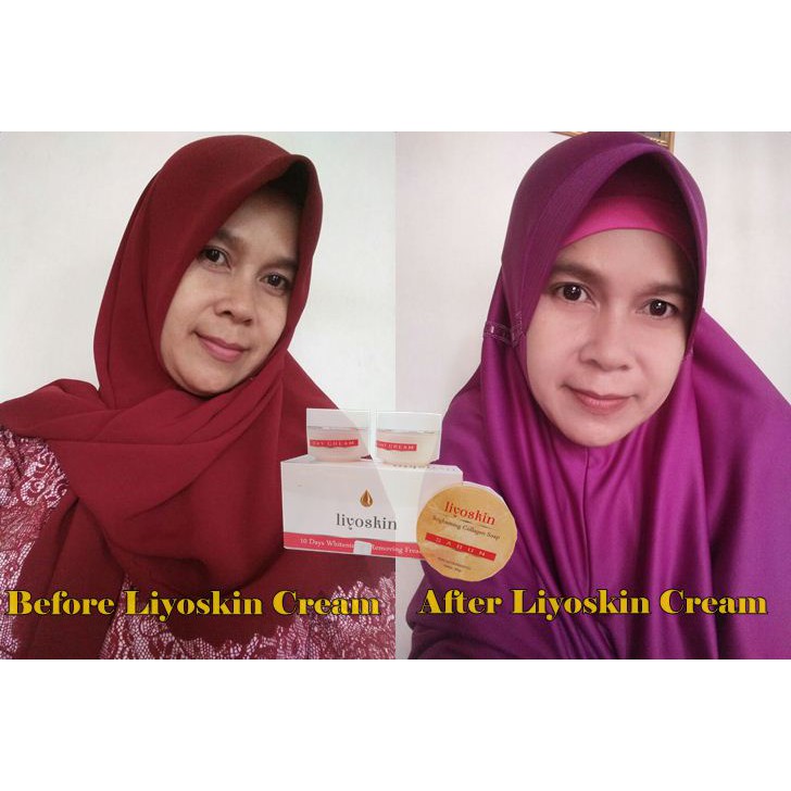 The Finest Beauty Salon Home Facebook cara mengatasi spruten di wajah