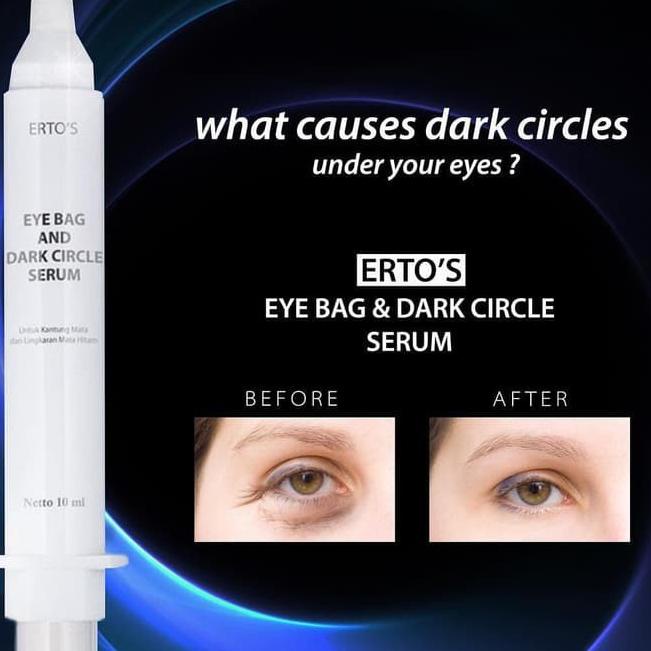 8.8 sale PENGHILANG MATA PANDA DAN KANTUNG MATA KERUTAN AMPUH PERMANEN  ERTOS EYE BAG DARK CIRCLE SER | Shopee Indonesia