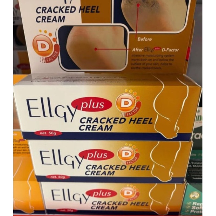 Jual Ellgy Plus Cracked Heel Cream / Cream Tumit Kaki Pecah Atau Kering