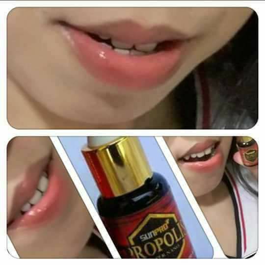 pemerah bibir permanen alami / Cara Memerahkan Bibir Yang Hitam Karena  Merokok Dengan Propolis NASA | Shopee Indonesia