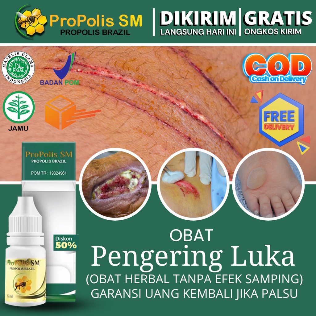 Jual Obat Pengering Luka Basah, Diabetes Basah, Bakar, Jahitan, Sunat