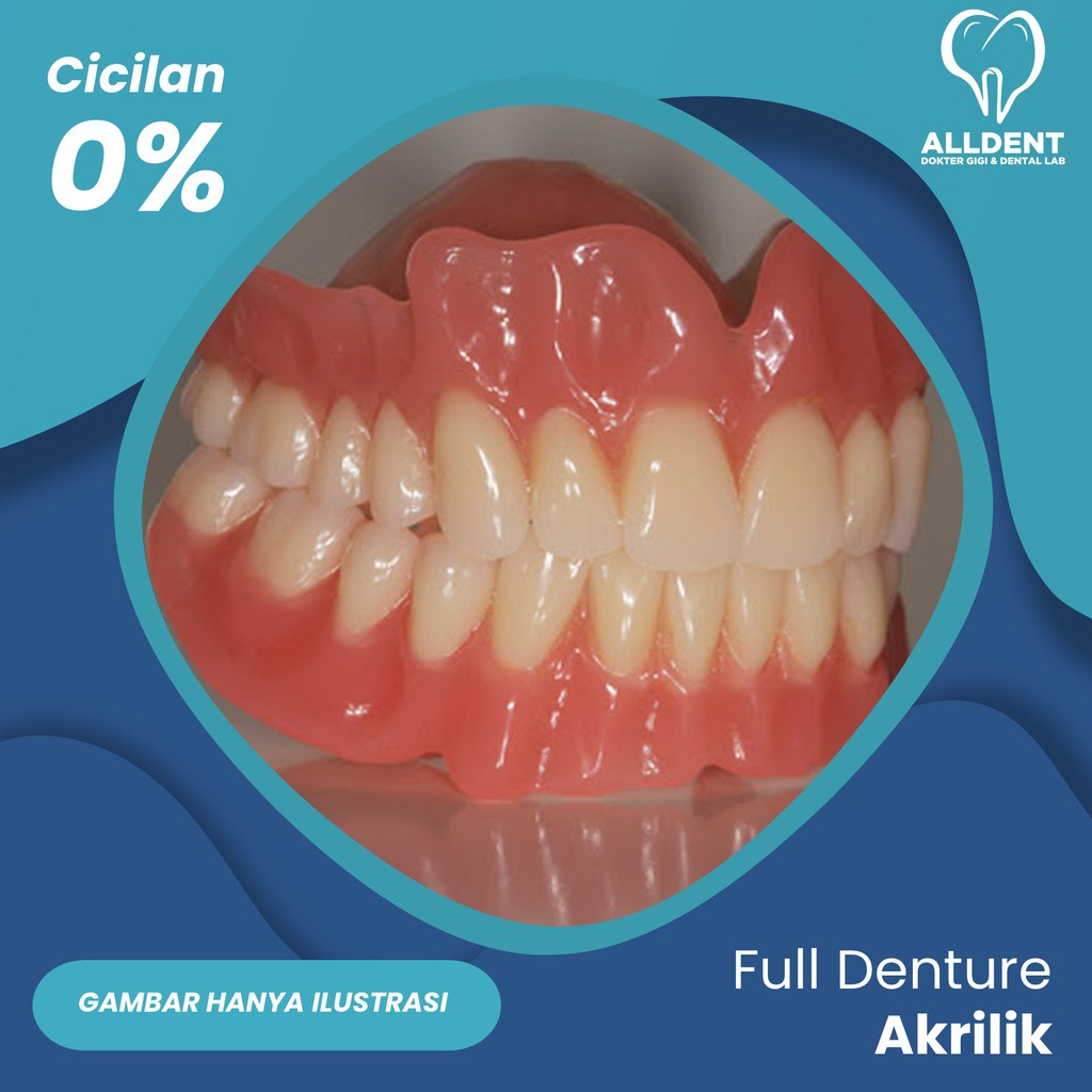 Jual Gigi Palsu Lepasan 2 Rahang Full Denture Akrilik Shopee Indonesia