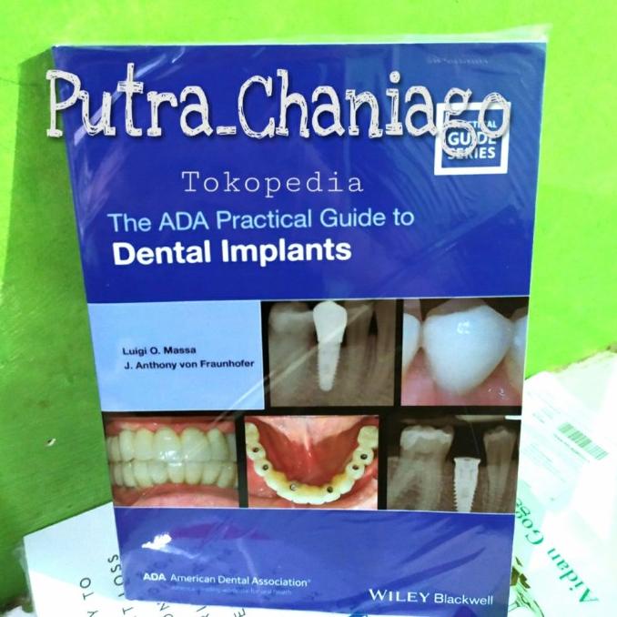 Jual Buku The Ada Practical Guide To Dental Implants Shopee Indonesia