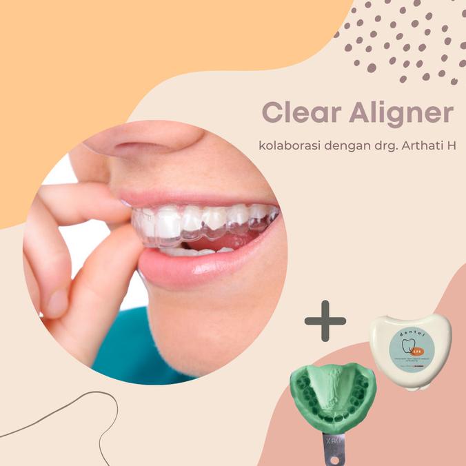 Harga Invisalign Terbaru Mei 2023 BigGo Indonesia