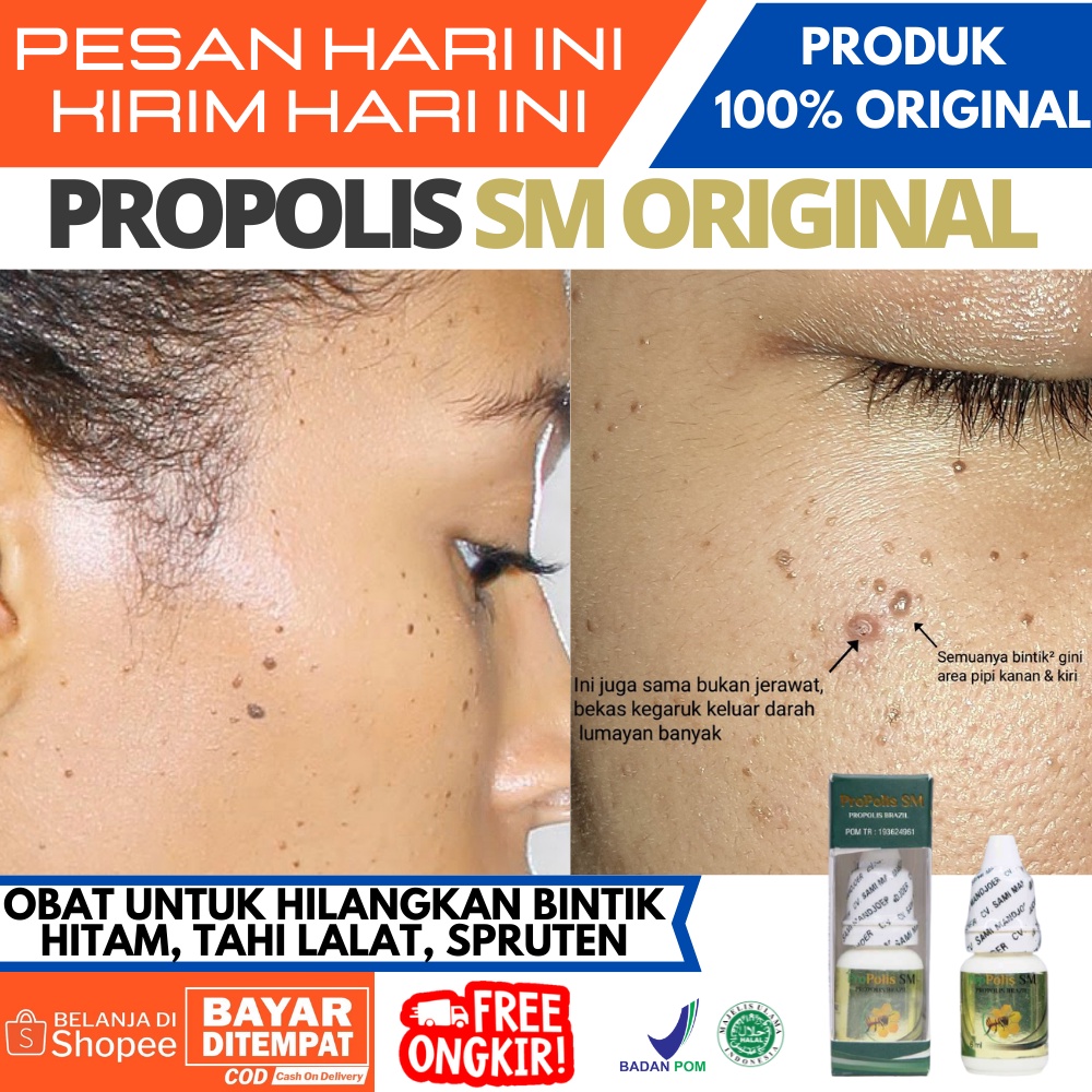 Jual Spruten Bintik Coklat Di Wajah Harga Terbaik & Termurah September 2022 | Shopee Indonesia
