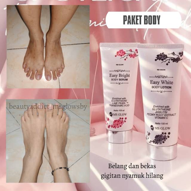 Jual Ms Glow Easy White Body Series Pemutih Badan Ms Glow Body Serum Kab Madiun Omah Wong Ayu Tokopedia pemutih badan ms glow