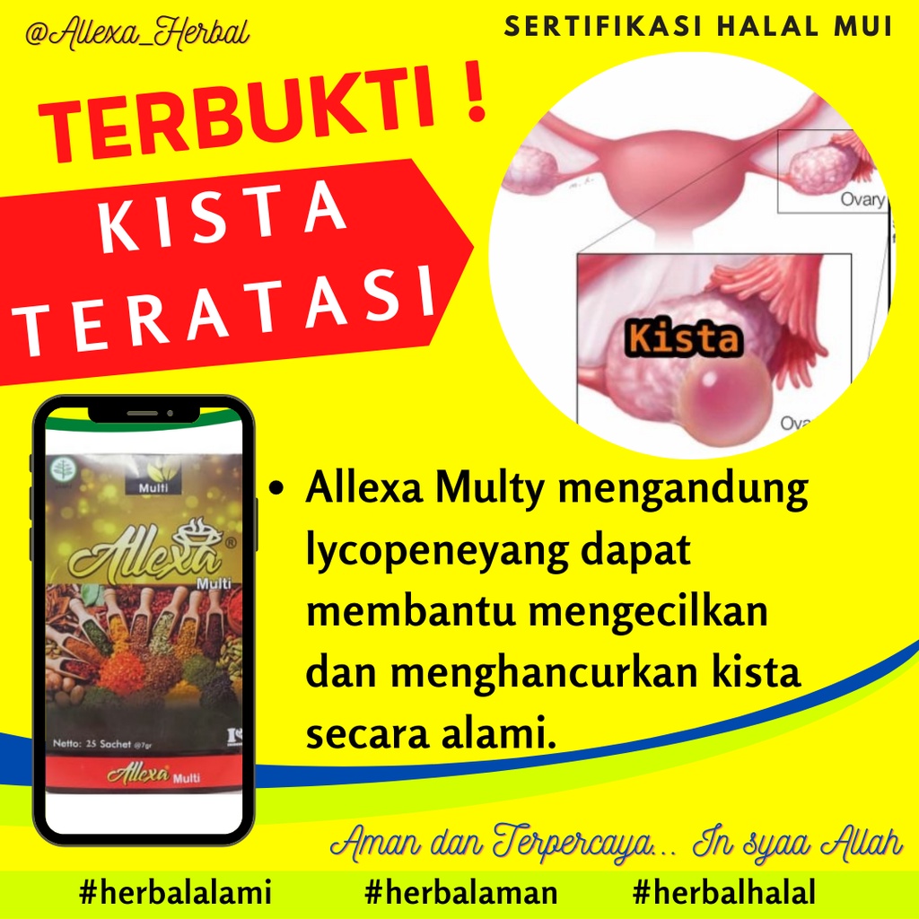 Jual Allexa Multy Obat Kista dan Miom Ovarium Obat Herbal Kista