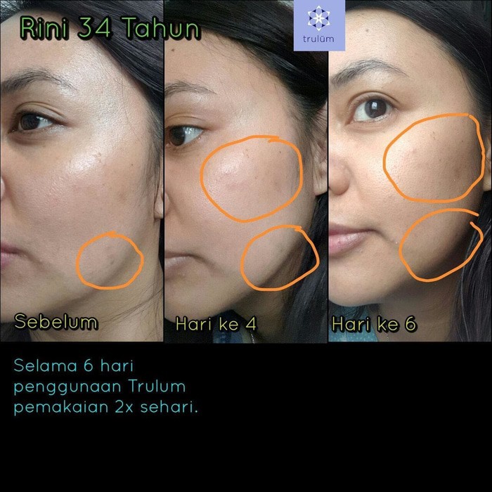 Wifi and cell signal isn't great everywhere. Jual Trulum Skincare Synergy 120ml Original Murah Diskon Shopee Indonesia