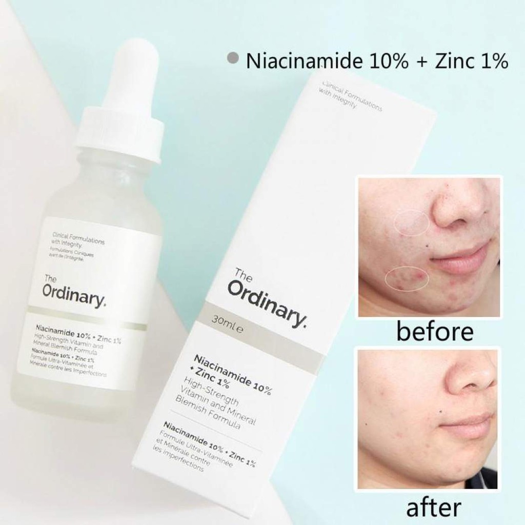 Jual The Ordinary Niacinamide 10% + Zinc 1% | Shopee Indonesia