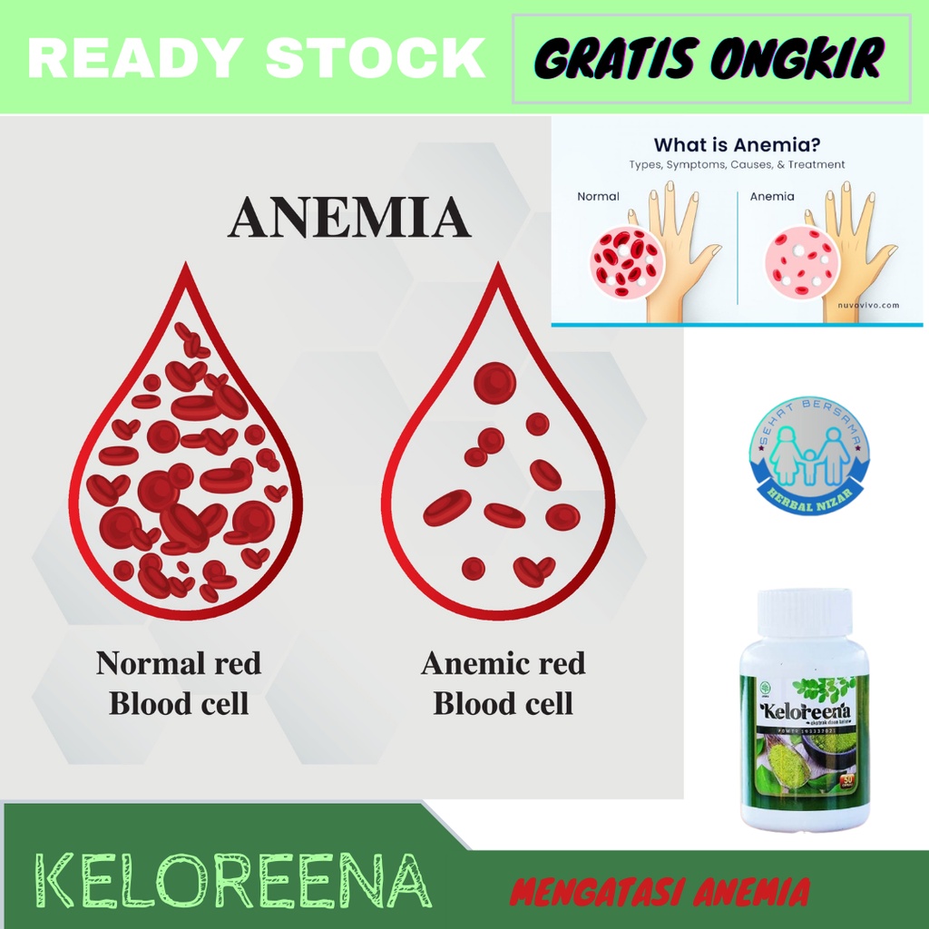 Jual Obat untuk Anemia, Obat Anemia Anak, Obat Anemia Dewasa, Obat