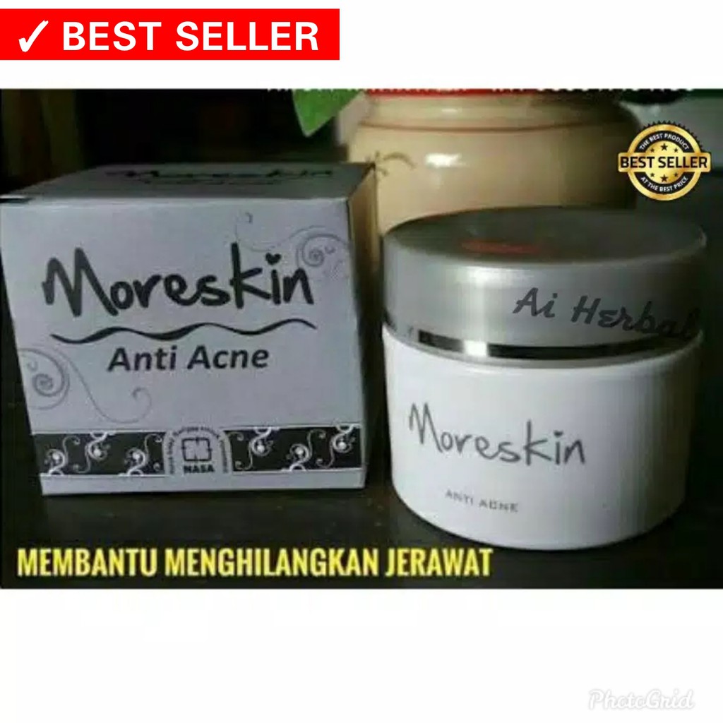 CREAM JERAWAT MORESKIN ANTI ACNE NASA ORIGINAL Shopee Indonesia