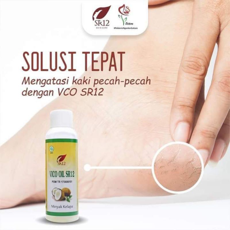 AMPUH OBAT KAKI PECAH PECAH/ VICO OIL / MINYAK KELAPA MURNI Shopee