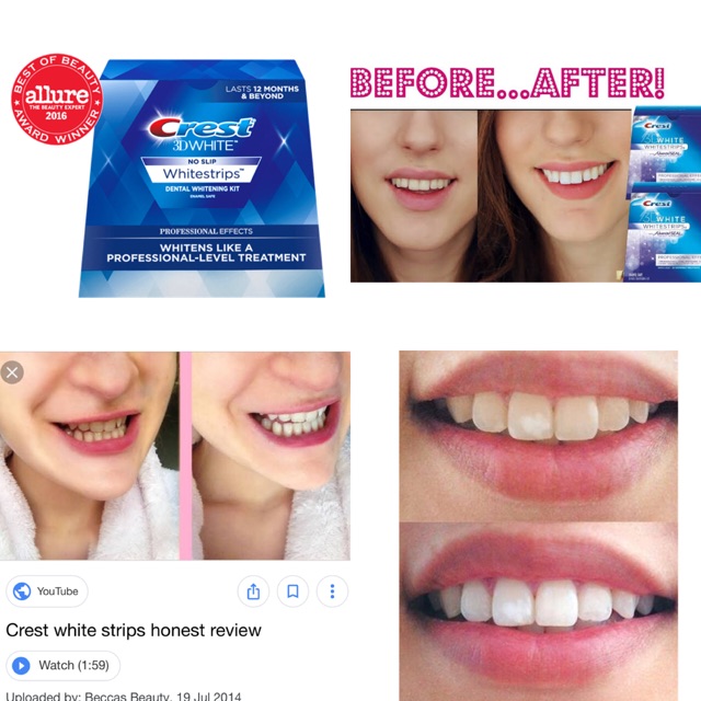 Jual Crest 3D Whitestrips ( Teeth Whitening ) Allure Winner 2016🎖 | Shopee Indonesia