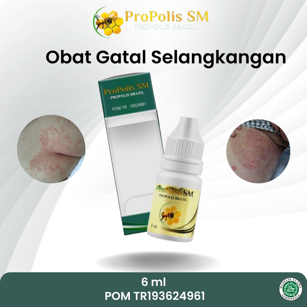 Obat Selangkangan Lecet Homecare24