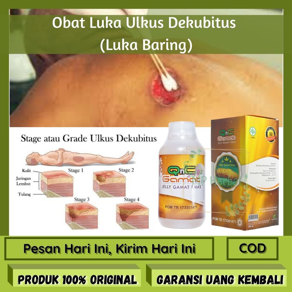Jual Obat Ulkus Dekubitus, Obat Luka Dekubitus, Obat Luka Sering