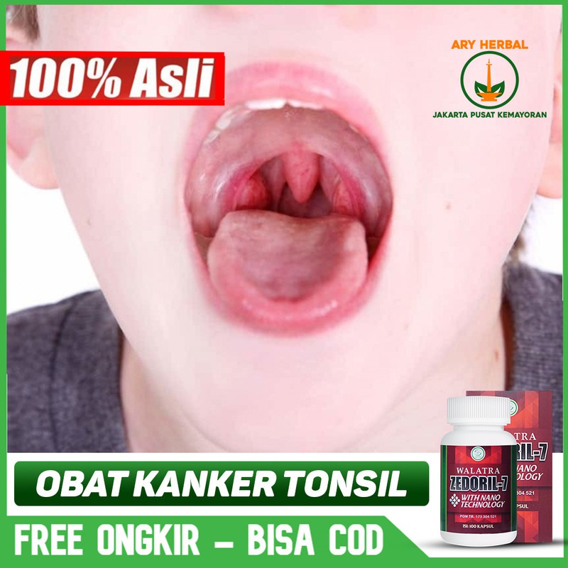 Jual Obat Kanker Tonsil, Amandel, Sakit Tenggorokan, Leher Zedoril 7  Walatra Original Obat Kanker Tumor Indonesia|Shopee Indonesia