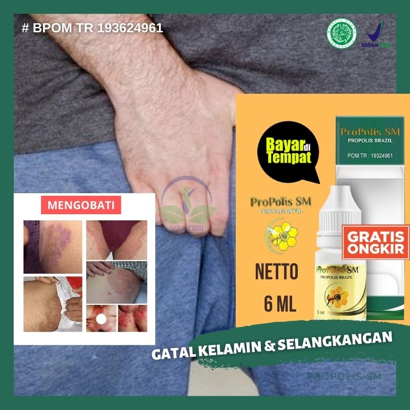 Jual Obat Penghilang Panu Kelamin, Mengobati Kurap di Area Kemaluan Wanita  dan Pria, Pelenyap Bercak Putih Di Selangkangan, Salep Gatal Kemaluan, Krim  Gatal Jamur Sekitar Kelamin, Gatal Seperti Digigit Semut, Ruam Alat