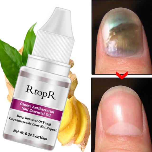 OBAT JAMUR KUKU / CANTENGAN / RTOPR Shopee Indonesia