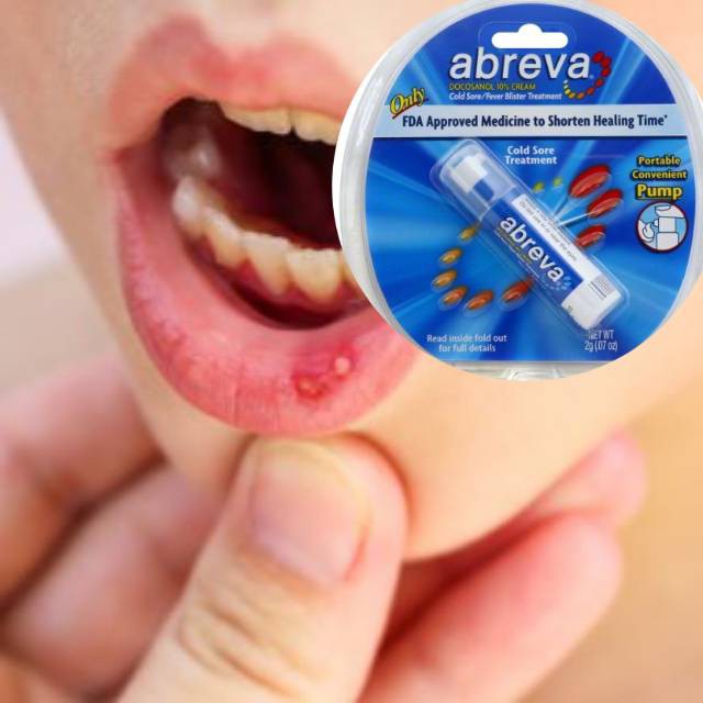 Abreva Cold Sore/Fever Blister Treatment Pump 2g. ของแท้USA Shopee