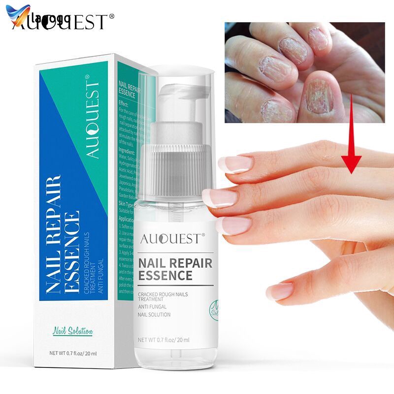 Antifungal Nail Paint Nail Lacquer Nail Ftempo