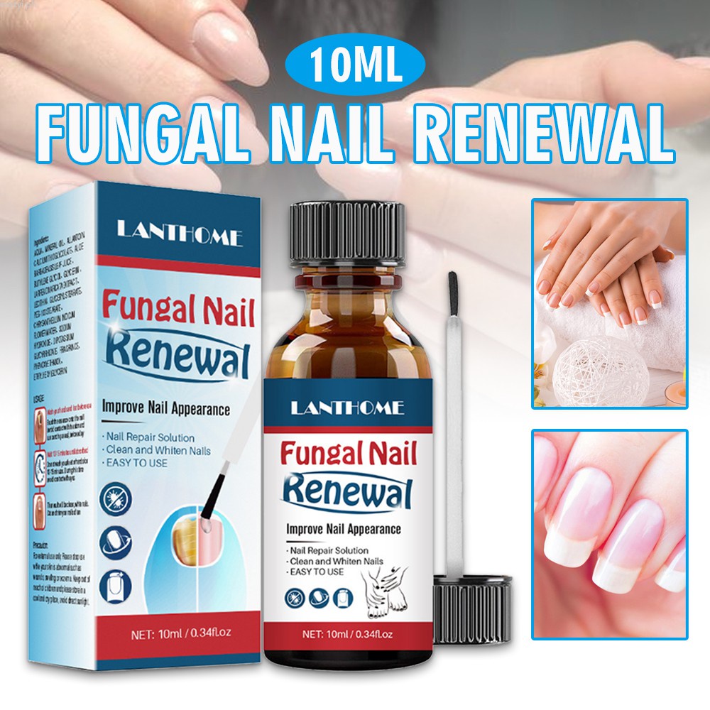Crazyi 10ml Fungal Nail Renewal Extra Strength Nail Fungus Treatment
