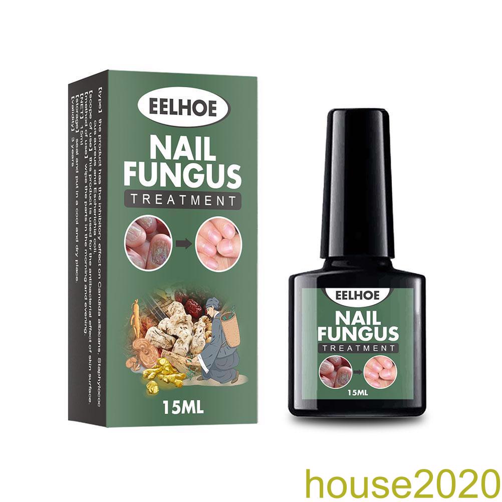 [house]15ml Nail Fungal Liquid Anti Fungus Toenail Fingernail Nails