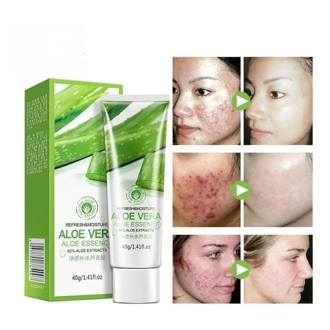 Creme Gel Clareador Melasma Manchas Cicatrizes Aloe Vera Shopee Brasil