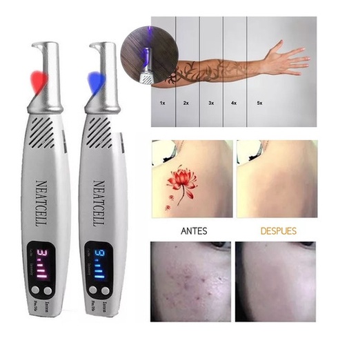 Neatcell Caneta Laser Remover Tatuagem Luz Azul- Vermelha Picosecond | Shopee Brasil 490_x_490_jpg