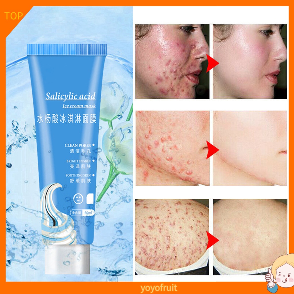 YOYO Salicylic Acid Acne Scars Blackhead Removal Hydrating Moisture