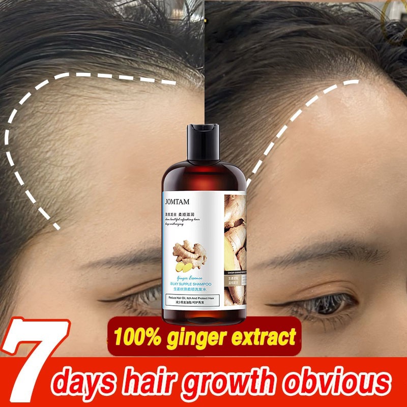 Ginger shampoo antihair loss refreshing oil control nourishing fast hair growth antidandruff