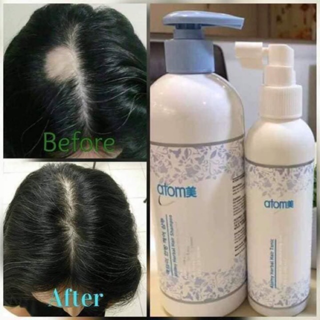 Atomy Hair Tonic (200ml) (free shipping, ORIGINAL) Shopee Malaysia