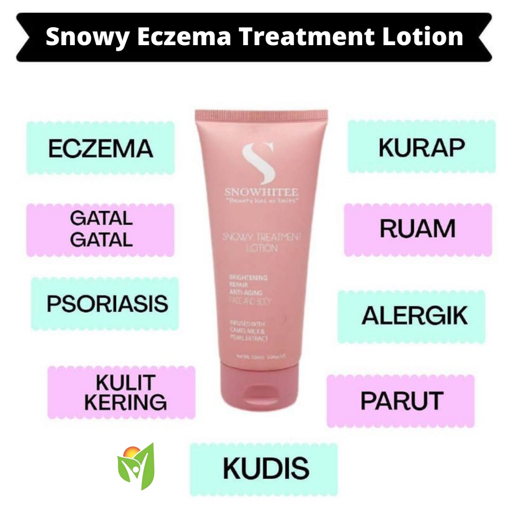 ECZEMA SNOWY TREATMENT LOTION by SNOWHITEE LULUS KKM Losyen Susu Unta