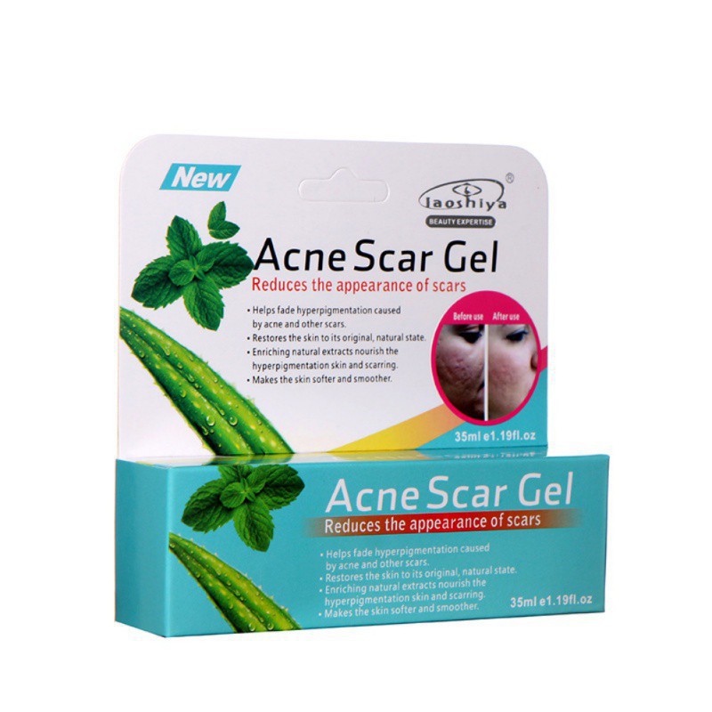 How To Use Aloe Vera Plant To Remove Acne Scars Plantă Blog
