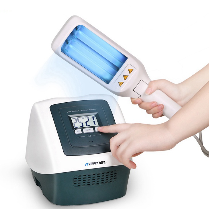 Narrow Band Uvb Light Therapy For Eczema Shelly Lighting