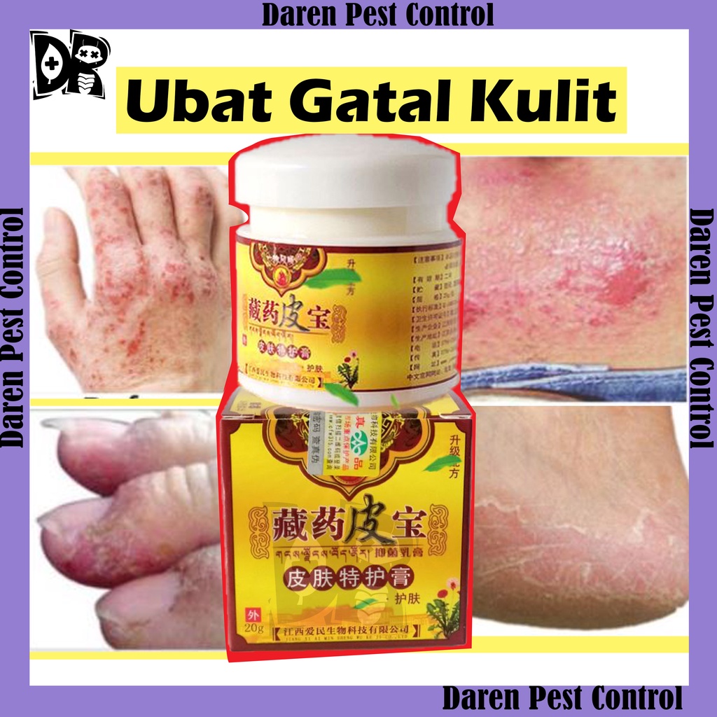 Eczema Cream Antifungal Cream Kurap panau gatai Antibacterial Skincare fungus Treatment Ubat
