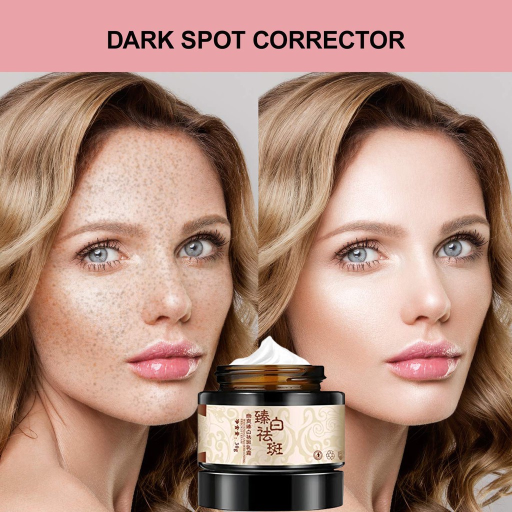 Dark Spot Removal Cream Freckle Remove Cream Dark Spots Corrector Fade