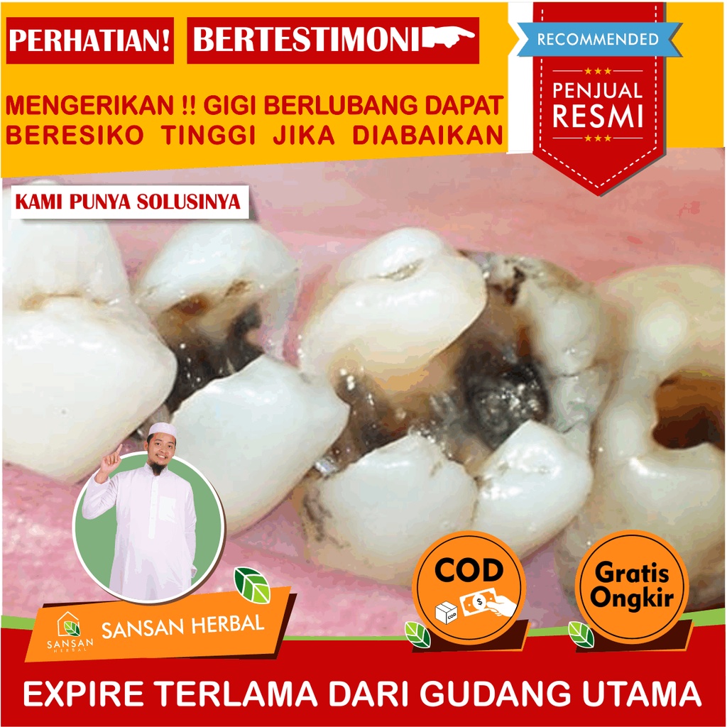 SM Cavities Cavities Tooth Pain Relief Medicine For Cavities, Teeth