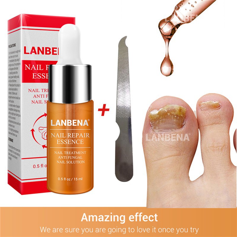 LANBENA Nail Repair Essence Oils Serum Fungal Nail Treatment Remove