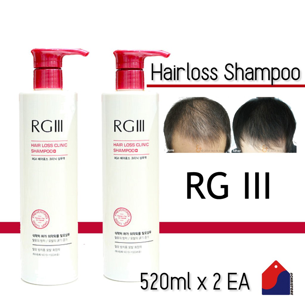 [1+1 COMBO] RG3 Hair Loss Clinic Shampoo Korean Red Ginseng 520ml x 2EA