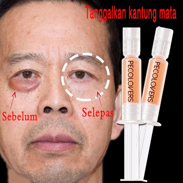 60s Instantly Eye Bag Removal Cream Eye Cream Anti Puffiness Wrinkles