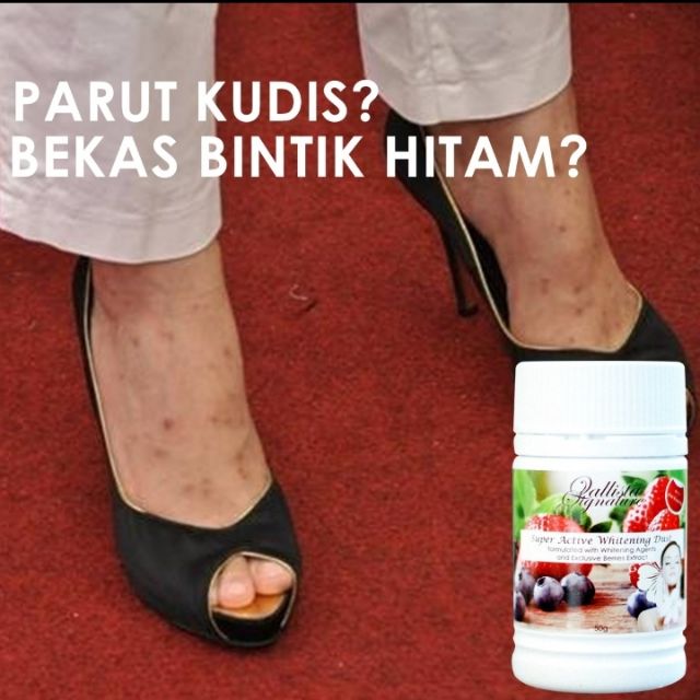 Cara Menghilangkan Parut Kudis Amirctzx