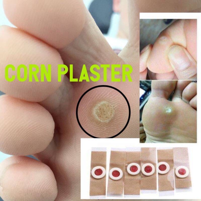 CORN PLASTER REMOVER 6Pcs Plaster ketuat kaki Tangan dan seluruh badan