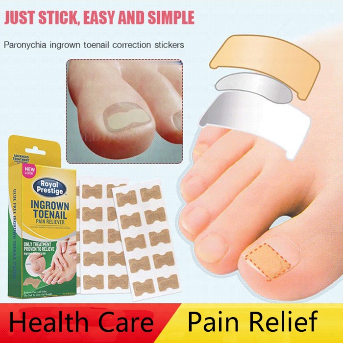 Paronychia Ingrown Toenail Correction Stickers Toenails Band Aid Relief