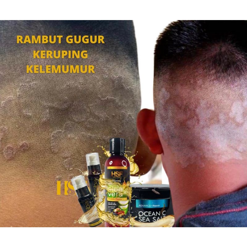 SHAMPOO ALOEVERA RAWAT RAMBUT KERUPING KELEMUMUR SHAMPOO CONDITIONER